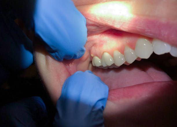 Best Emergency Dental Services for Seniors in Lyles, TN