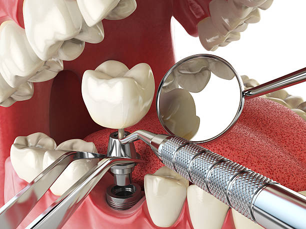 Best Emergency Cosmetic Dentistry in Lyles, TN