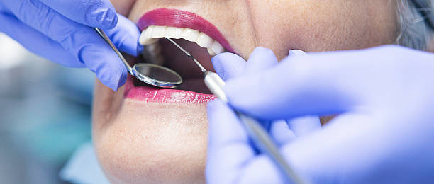 Best Emergency Dentist for Lost Fillings or Crowns in Lyles, TN